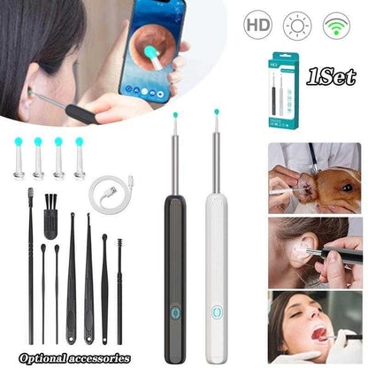 1080P HD Smart Earwax Removal Kit – Safe & Easy Cleaning
