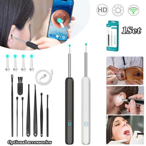 1080P HD Smart Earwax Removal Kit – Safe & Easy Cleaning