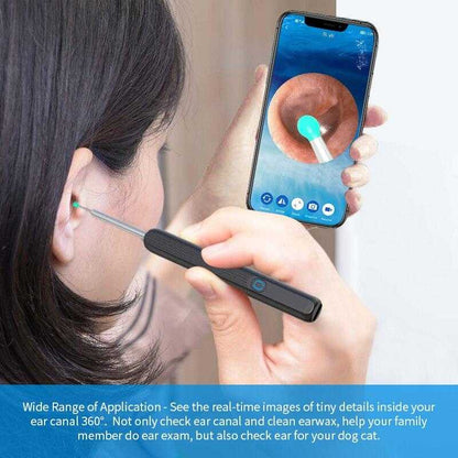 1080P HD Smart Earwax Removal Kit – Safe & Easy Cleaning