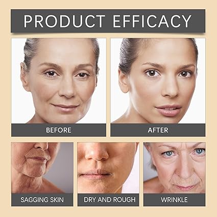 Bee Venom Botox Wrinkle Cream Your Daily Glow, Fresh & Radiant