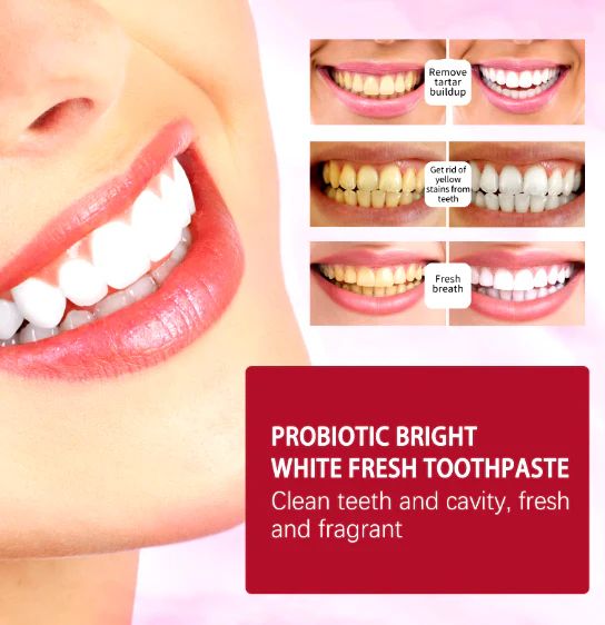 SP-4 Probiotic Teeth Whitening Toothpaste
